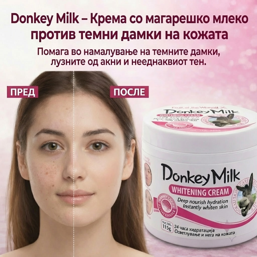 Donkey Milk – Крема Против Флеки На Кожата Од Магарешко Млеко
